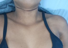1000090429