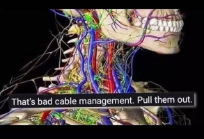 Bad cable management