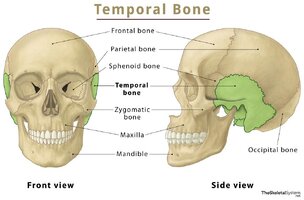 Temporal-Bone.jpg