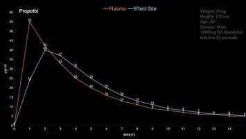 1000mg 5 Anestofol 70kg bolus