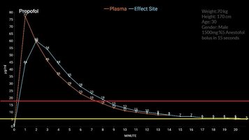1500mg 5 Anestofol 70kg bolus