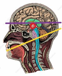 C0123876 Head and Brain Anatomy