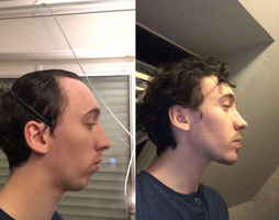 Jaw