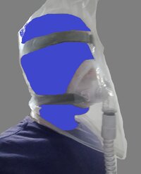 Cpap_plastic2.jpg